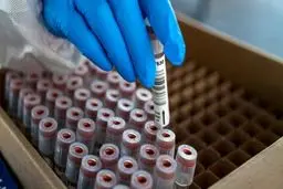 همه آنچه که باید درباره آبله میمون بدانید