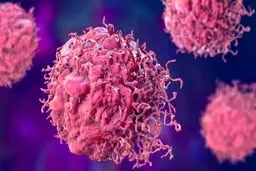 وضعیت شیوع یک سرطان زنانه در ایران/احتمال ورود واکسن HPV به برنامه واکسیناسیون ملی