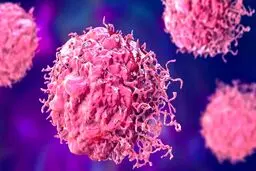 وضعیت شیوع یک سرطان زنانه در ایران/احتمال ورود واکسن HPV به برنامه واکسیناسیون ملی