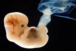 خط ویژه مشاوره تلفنی حفظ حیات جنین راه اندازی شد