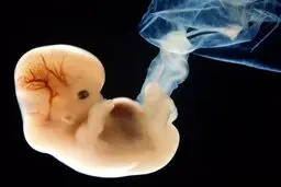 خط ویژه مشاوره تلفنی حفظ حیات جنین راه اندازی شد