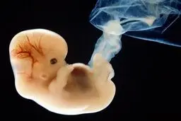 خط ویژه مشاوره تلفنی حفظ حیات جنین راه اندازی شد