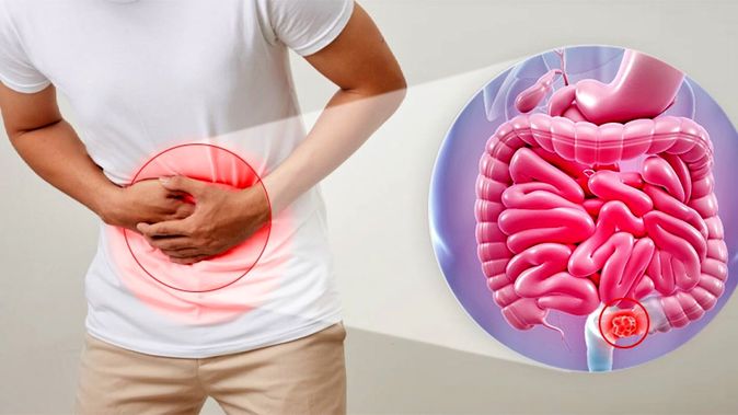 دلایل بروز “یبوست” چیست؟