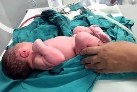 حمایت ۹۰ درصدی بیمه برای خدمات درمانی ناباروری