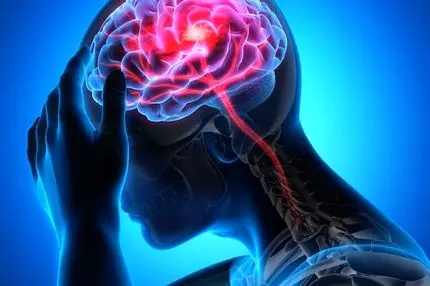 آمار تکان‌دهنده سکته مغزی روزانه در تهران