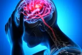 آمار تکان‌دهنده سکته مغزی روزانه در تهران